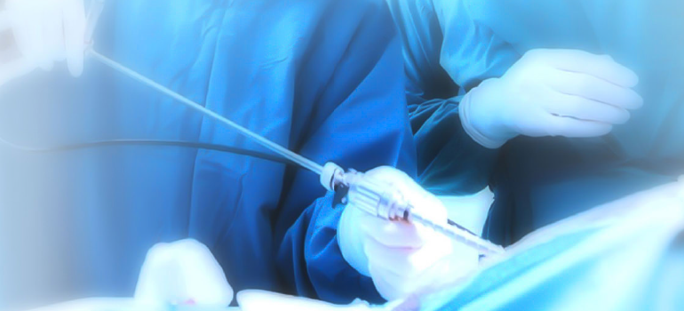 Vantagens da Cirurgia por Videolaparoscopia