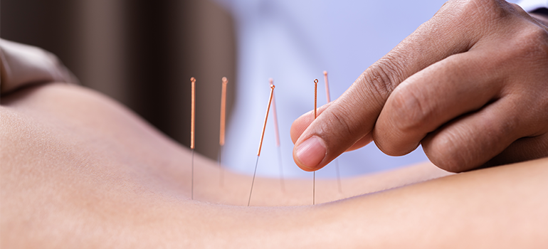 A acupuntura no tratamento dos sintomas do transtorno de ansiedade